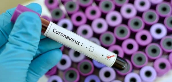 China a anuntat ca a izolat cu succes tulpina noului coronavirus si sustine ca e pe cale sa produca un vaccin
